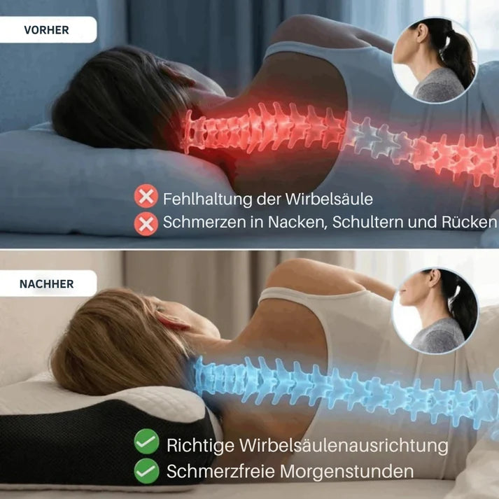 ErgoPillow™ | Gib dem Nacken die Unterstützung, die er jede Nacht vermisst hat