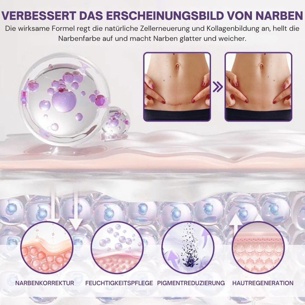 RegenScar™ | Für glattere und weniger auffällige Narben