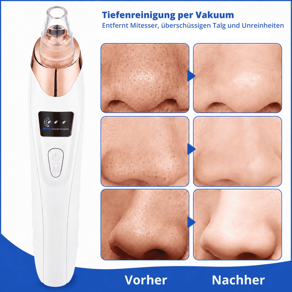 ClearPore™ | Gezielte Porenpflege für ein sichtbar reineres und ebenmäßigeres Hautbild