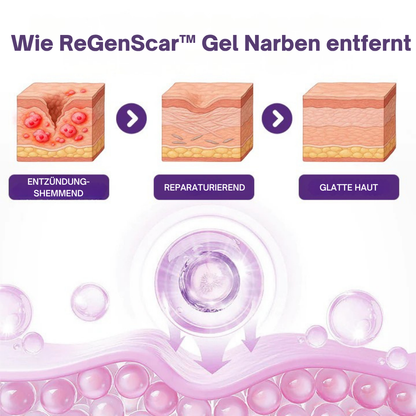 RegenScar™ | Für glattere und weniger auffällige Narben