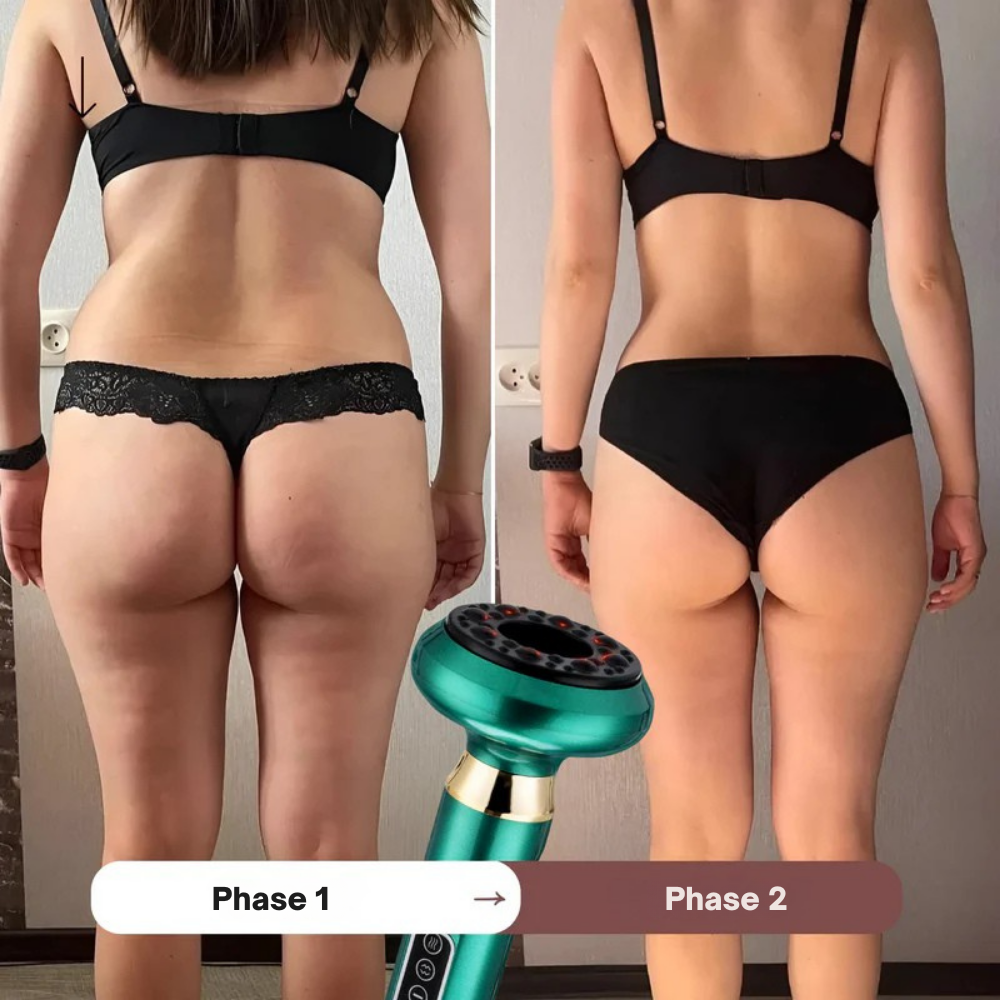 CelluSculpt™ | Entdecken Sie sichtbar glattere und straffere Haut