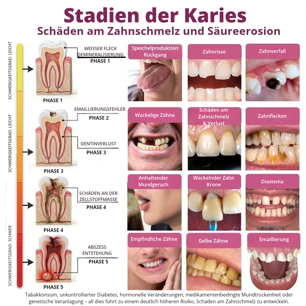 DenPerm™ | Gezielte Pflege für geschwächten Zahnschmelz