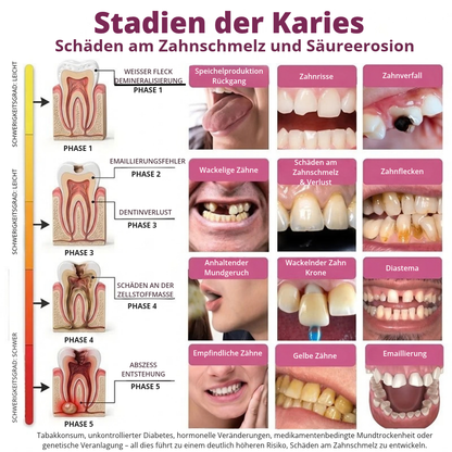 DenPerm™ | Gezielte Pflege für geschwächten Zahnschmelz