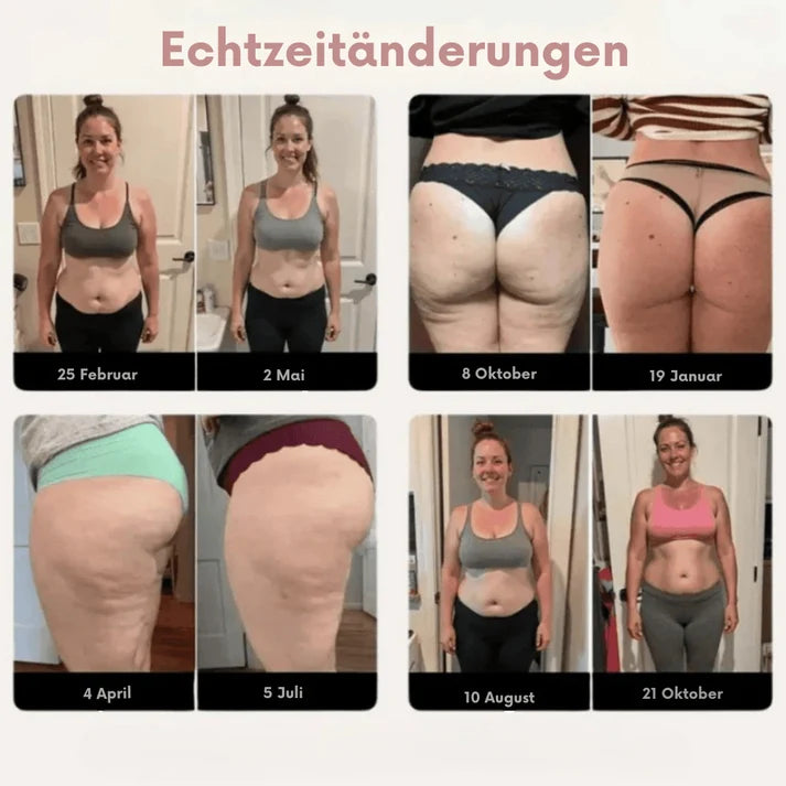SculptWear™ | Leggings, die aktiv gegen Cellulite arbeiten