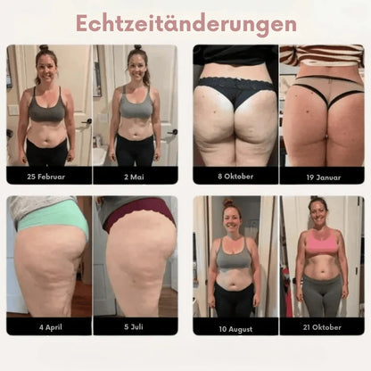 SculptWear™ | Leggings, die aktiv gegen Cellulite arbeiten