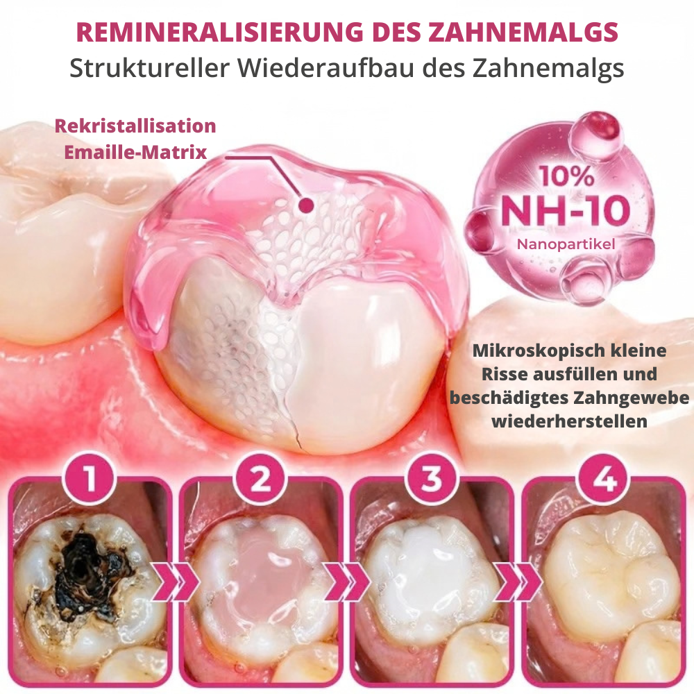 DenPerm™ | Gezielte Pflege für geschwächten Zahnschmelz