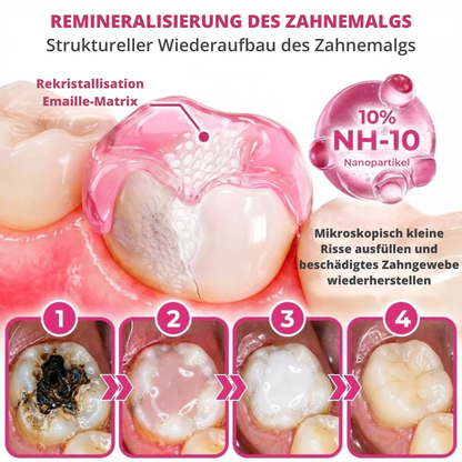 DenPerm™ | Gezielte Pflege für geschwächten Zahnschmelz